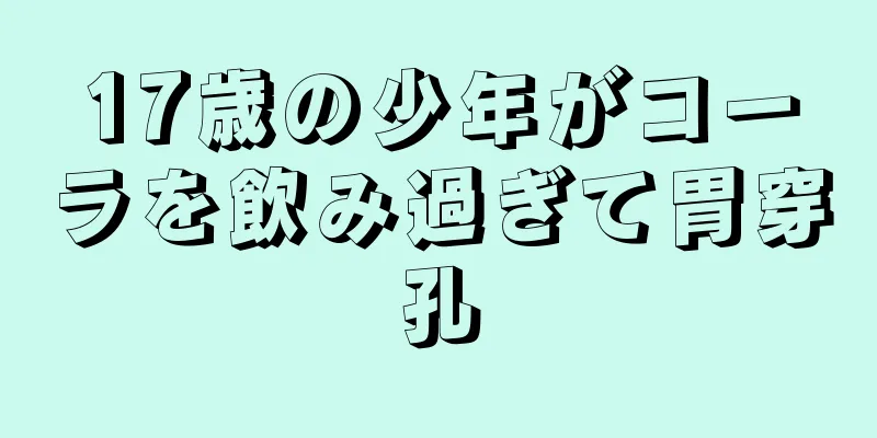 17歳の少年がコーラを飲み過ぎて胃穿孔